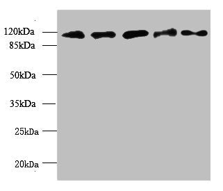 MORC2 Antibody