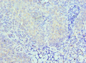 CARD8 Antibody