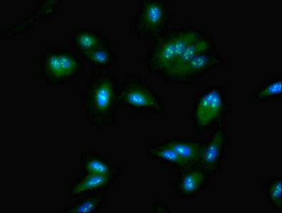 NOP58 Antibody