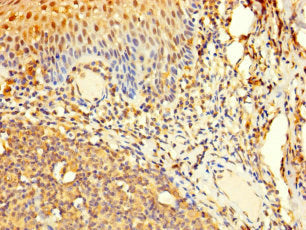 AAR2 Antibody