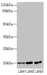 TPRKB Antibody
