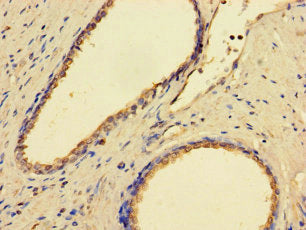 GMPPB Antibody