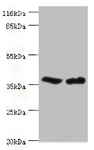 CA5B Antibody