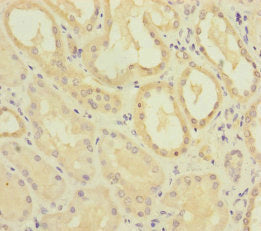 MMACHC Antibody
