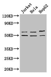 YTHDF2 Antibody