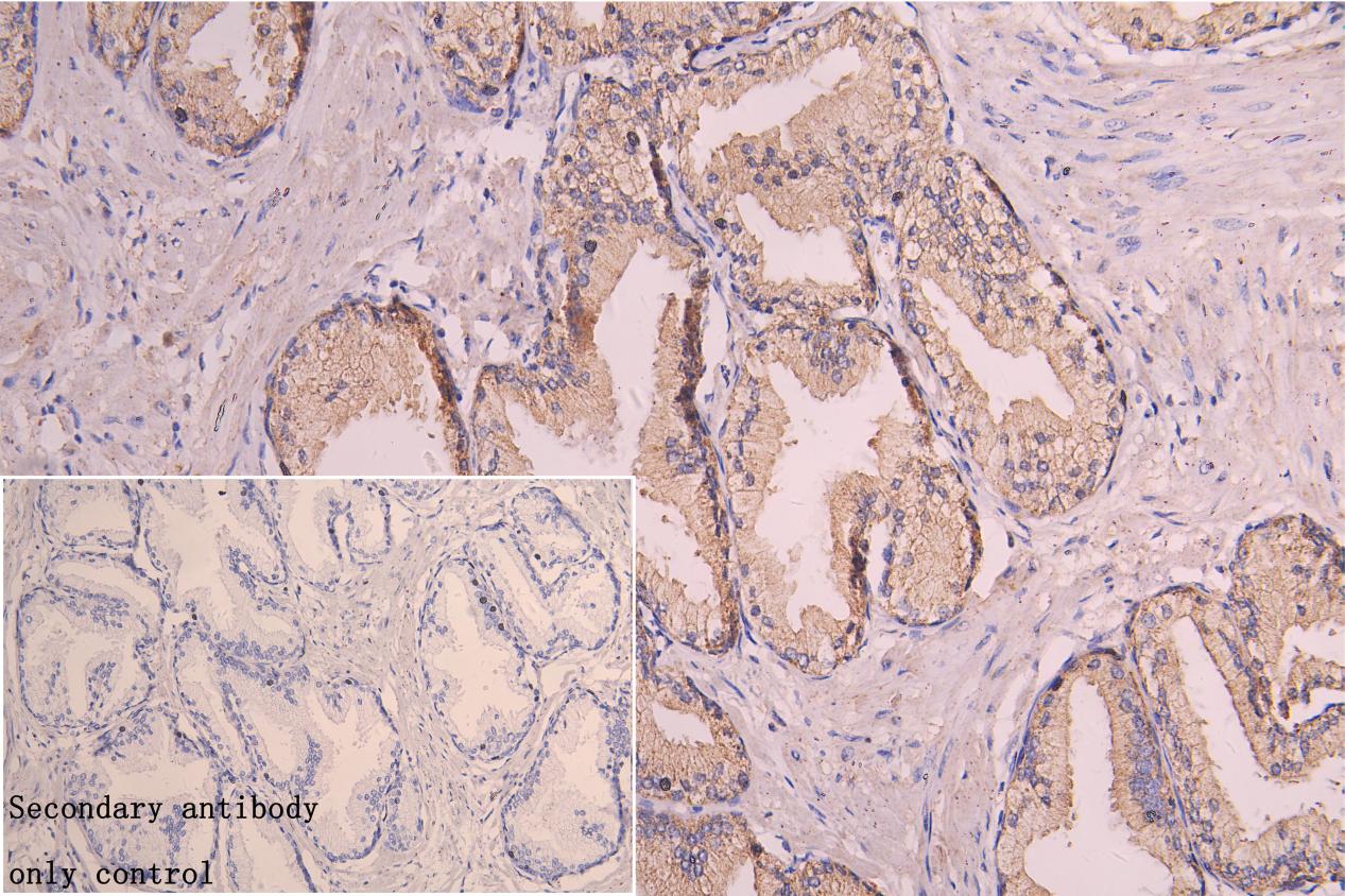 CORIN Antibody