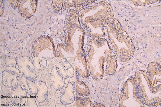 CORIN Antibody
