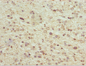 MAGED1 Antibody