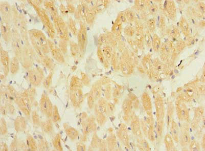 TP53TG5 Antibody