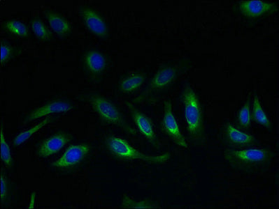 SLC17A4 Antibody