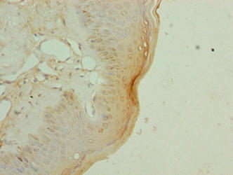 EXOSC1 Antibody
