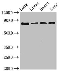 LOXL2 Antibody