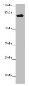 LRCH1 Antibody