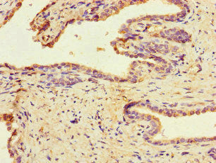 MAST1 Antibody