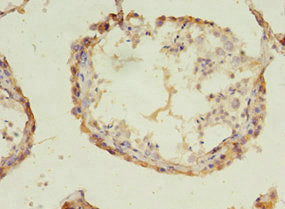 ACOT9 Antibody