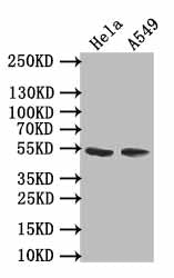 TRIM17 Antibody