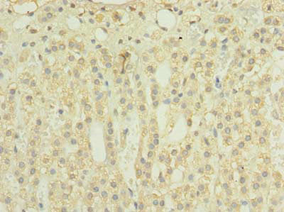 TIMM8B Antibody