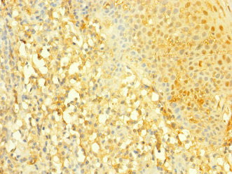 SLC4A7 Antibody