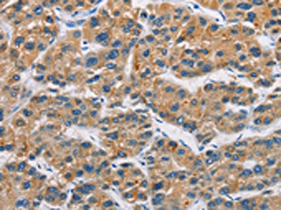 CERK Antibody