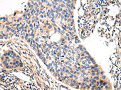 VASH1 Antibody