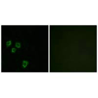 MUC16 Antibody