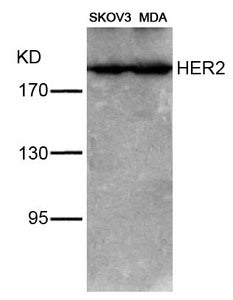 ERBB2 (Ab-1221/1222) Antibody