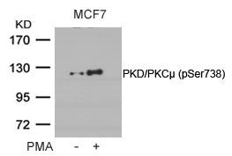 Phospho-PRKD1 (Ser738) Antibody