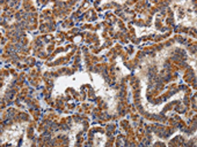KLK6 Antibody
