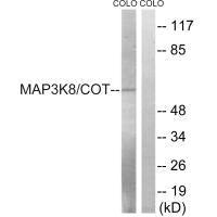 MAP3K8 (Ab-400) Antibody