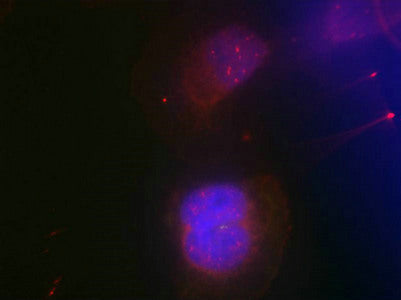 Phospho-BRCA1 (Ser988) Antibody