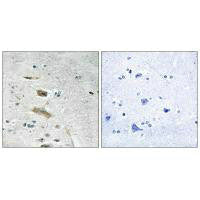 ABHD4 Antibody
