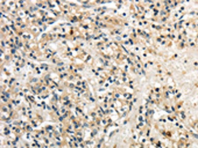 GPT Antibody
