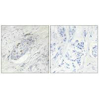 ZNF232 Antibody