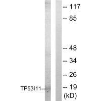 TP53I11 Antibody