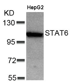 STAT6 (Ab-641) Antibody