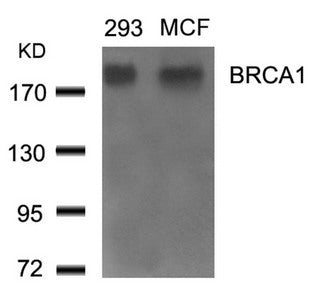 BRCA1 (Ab-1524) Antibody