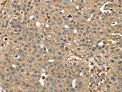 RNH1 Antibody
