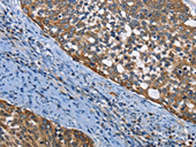 PGK1 Antibody
