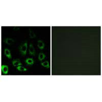 MBTPS2 Antibody