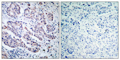 TYK2 (Ab-1054) Antibody