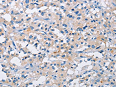 ATP6AP2 Antibody
