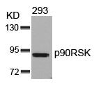 RPS6KA1 (Ab-352) Antibody