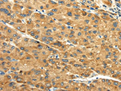 GPT Antibody
