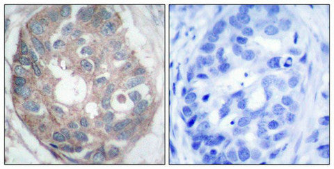 DAB1 (Ab-232) Antibody