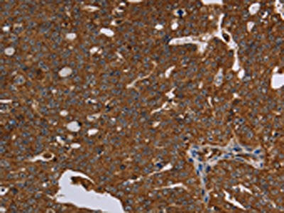 HSD17B13 Antibody