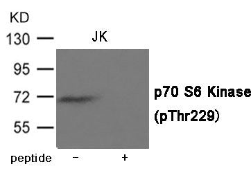 Phospho-RPS6KB1 (Thr229) Antibody