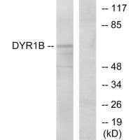 DYRK1B Antibody