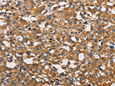 NPPA Antibody