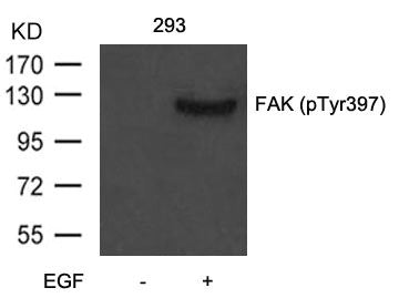 Phospho-PTK2 (Tyr397) Antibody