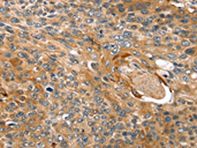 TAGLN Antibody